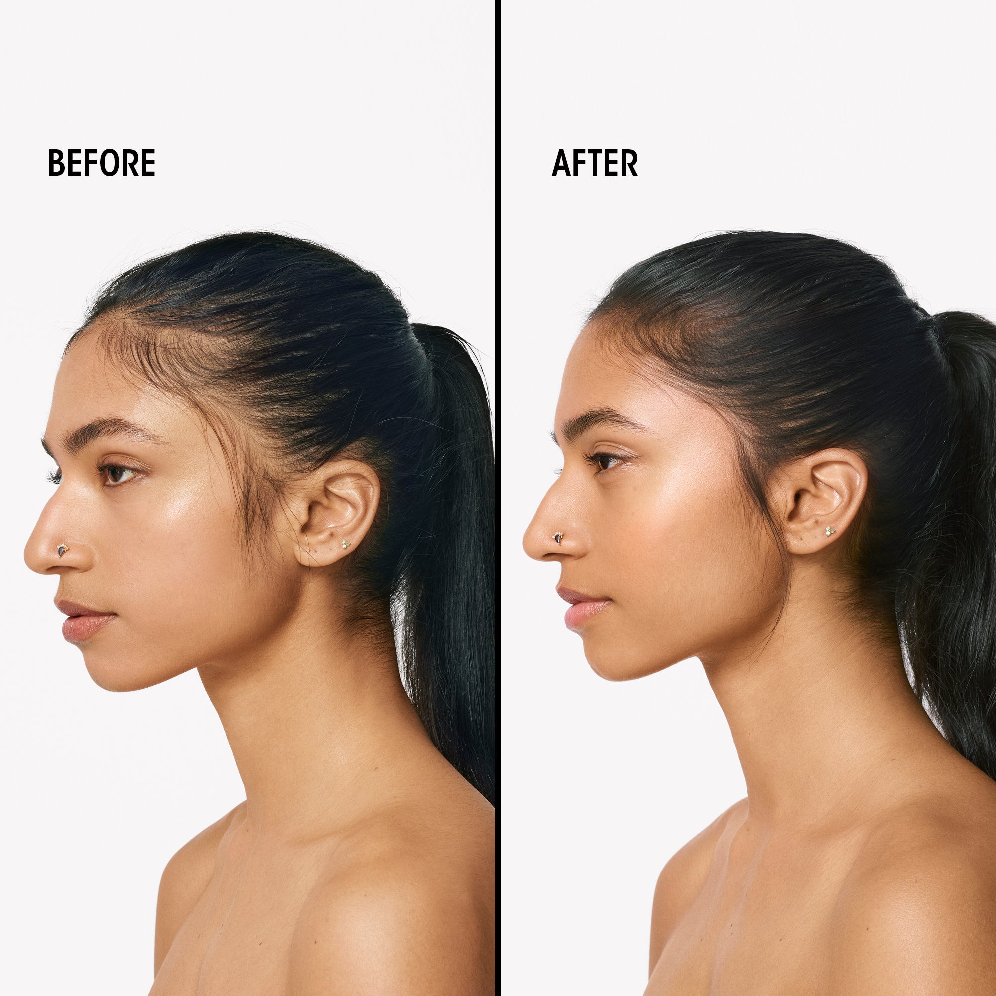 Serene Scalp Densifying Treatment Spray